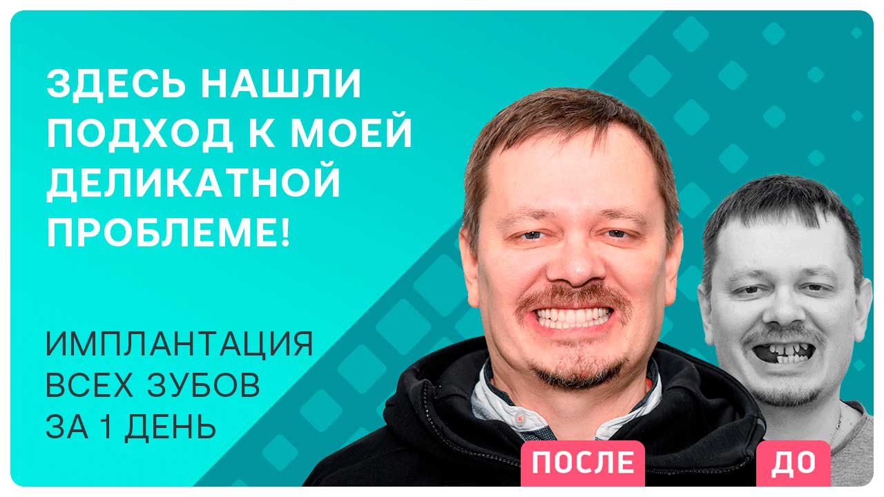 Как ставить импланты и протезы при рвотном рефлексе. Рассказывает реальный пациент!