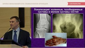 Современные методы диагностики и принципы лечения раннего остеоартроза