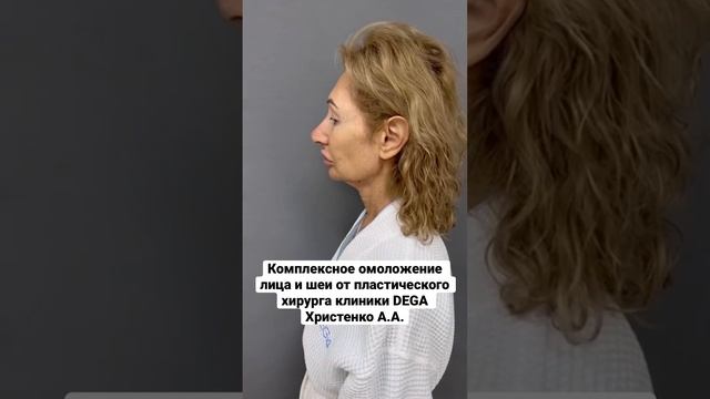 Вау-преображение от пластического хирурга клиники DEGA Артура Александровича Христенко ?