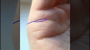 #Хиромантия Остров на линии брака.