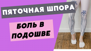 Болят ноги? Пяточная шпора, боль в подошве, ахиллодиния, деформация хаглунда - что делать?