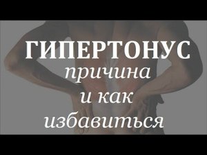 ГИПЕРТОНУС мышц - что это? | Причина и лечение
