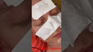 МАСКА ОТ ЧЕРНЫХ ТОЧЕК LANBENA