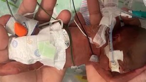 Ребенок РОДИЛСЯ СО 4 МЕСЯЦАМИ, и никто не ожидал, что после этого произойдет