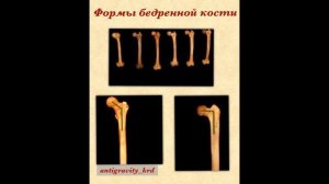 13 ЛЕКЦИЯ. Биомеханика поперечного шпагата. Мышцы, связки, кости.
