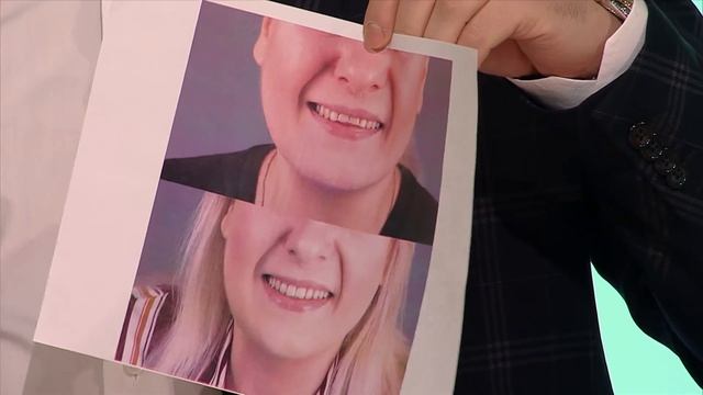 ЭСТЕТИЧЕСКАЯ РЕСТАВРАЦИЯ: КОГДА ВРАЧ СТАНОВИТСЯ ХУДОЖНИКОМ смотреть онлайн