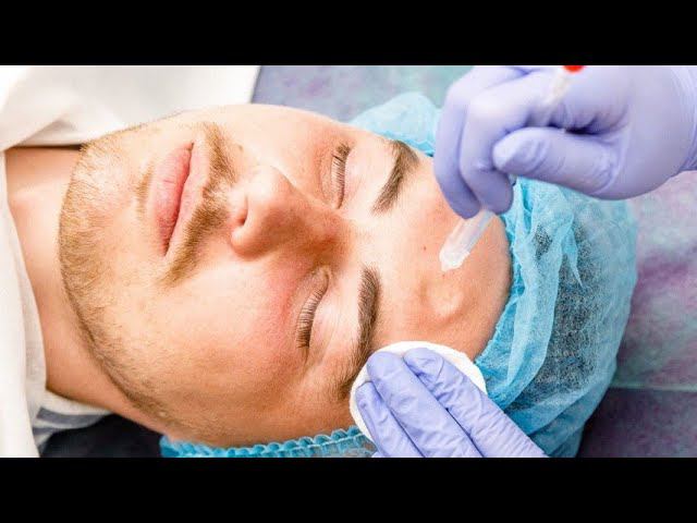 Jet Peel - кислородный коктейль для молодости кожи #косметология #jetpeel  #косметолог #пилинглица