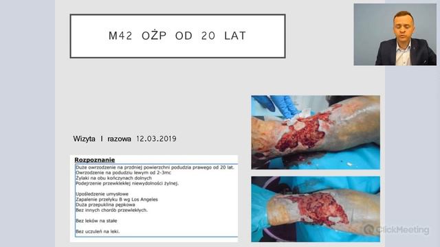 Rany przewlekłe analiza przypadków krok po kroku смотреть онлайн