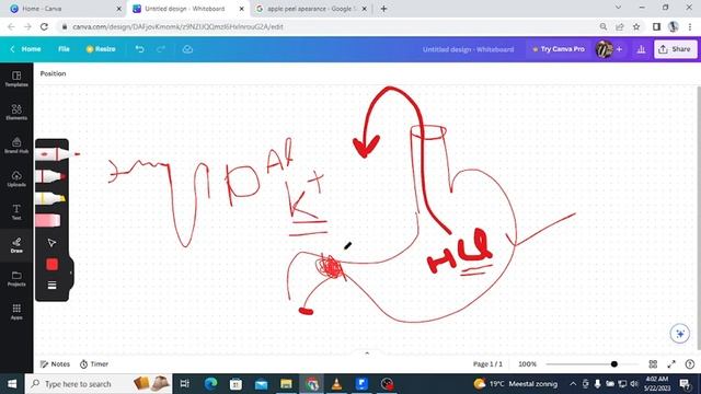 First Aid + Annotated Uworld read With me GIT Part 1 (Embryology) смотреть онлайн