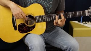 Kesha - Die Young - Acoustic Guitar Lesson - EASY