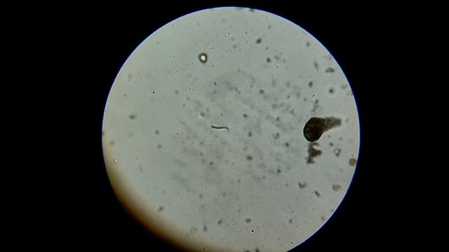 марс с телескопа 200 мм dob. марс в телескоп 2020. микроскоп 100 крат. оптический микроскоп 1500 крат. юпитер в телескоп 125 крат.