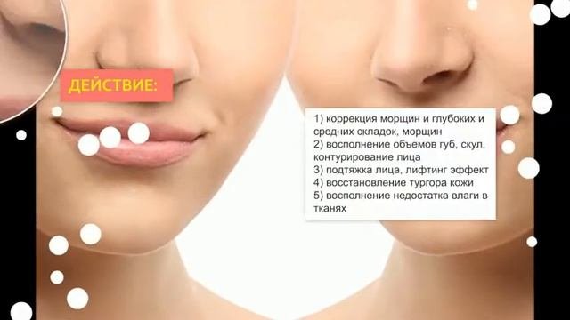 Филлер Stylage M I 2Filler.ru