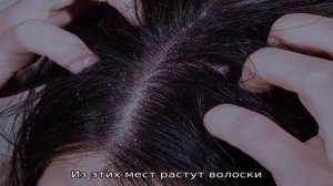 Грибок на голове: симптомы фото