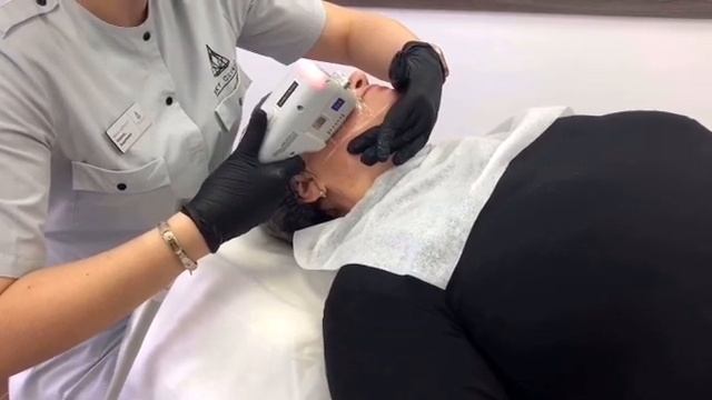 SMAS-лифтинг смотреть онлайн