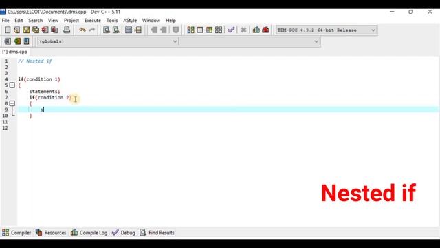 # 13 Decision making statements in C Programming in Tamil | if | if else | else if ladder | switch