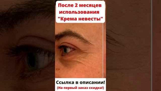 ?Уход за кожей лица! Мгновенный лифтинг! ? "Крем невесты" #омоложениелица #лифтинглица