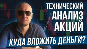 Технический анализ акций. Куда вложить деньги?