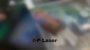 Laser Cleaning: HIGH POWER 1000W!