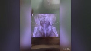 Как сфотографировать рентгеновские снимки в домашних условиях?