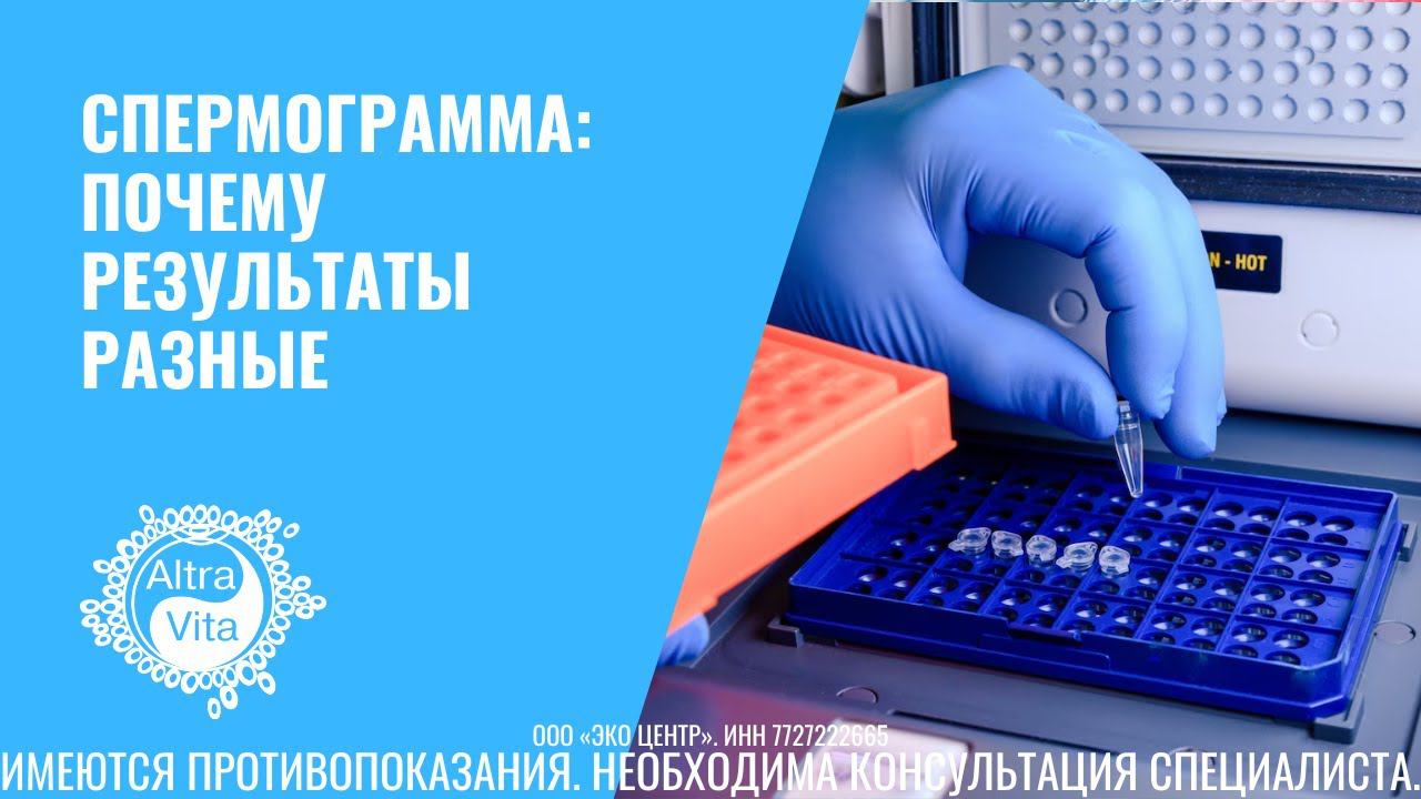 Показатели спермограммы: морфология