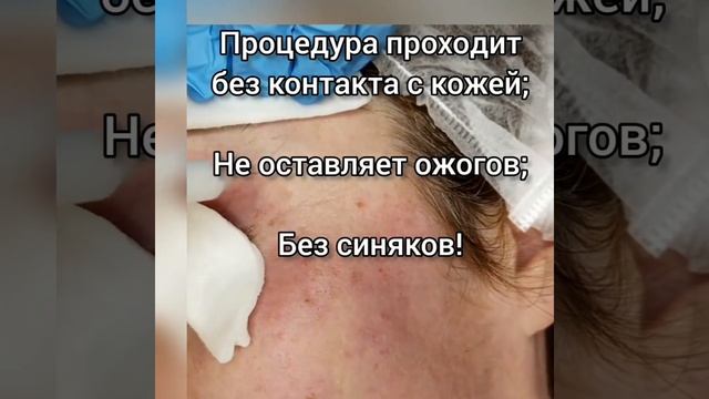 ЧЕМ ОТЛИЧАЕТСЯ ХОЛОДНАЯ ПЛАЗМА ОТ ГОРЯЧЕЙ.
