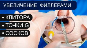 Увеличение клитора, точки G, сосков филлерами / контурная пластика/ гиалуроновая кислота