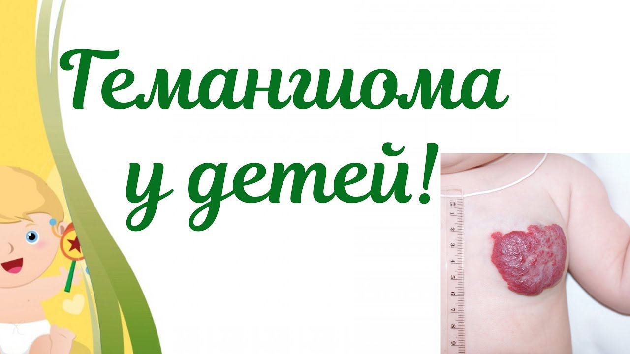 Гемангиома у новорожденных.Действия мамы при гемангиоме!