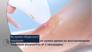УДАЛЕНИЕ СОСУДИСТЫХ СЕТОК на ногах лазером