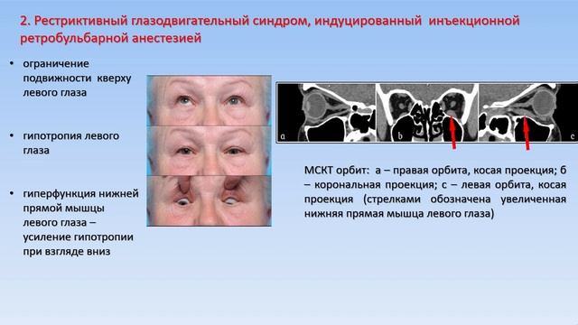 Офтальмология и геронтология 2021 - часть 3 смотреть онлайн