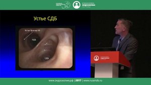 Анестезия и методика осмотра бронхиального дерева