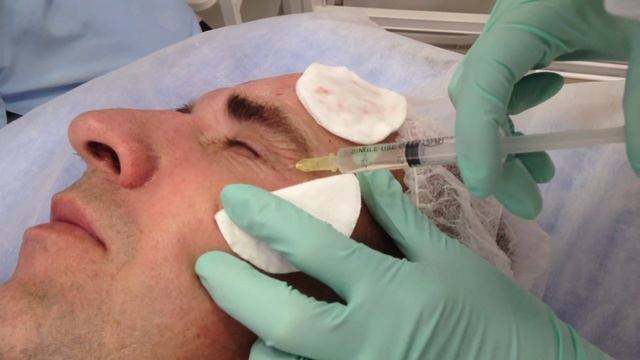 Обучение экзамен по биоревитализации смотреть онлайн