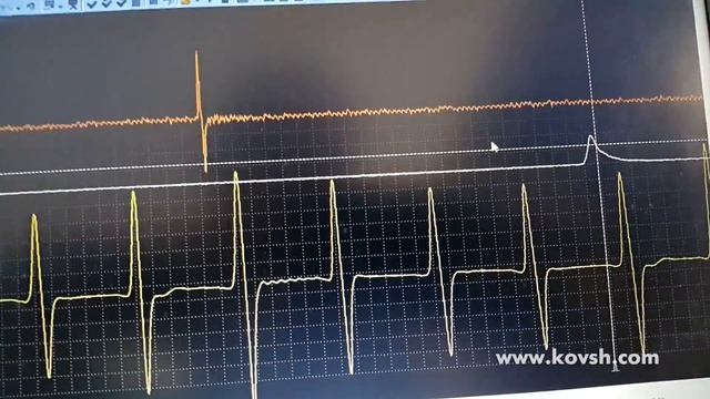 Определение момента впрыска топлива на механических насосах при работающем двигателе смотреть онлайн