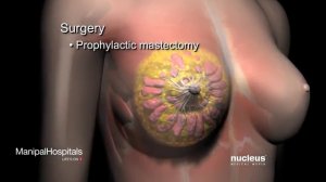 Breast Cancer Surgery Hospitals WITH BEST Cancer Treatment Hospital in India Oncology Surgeons 