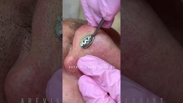 Ручная чистка лица смотреть онлайн