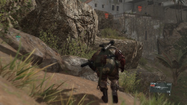 Metal Gear Solid 5: The Phantom Pain - Бедолага 04