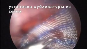 Лапароскопическая герниопластика при пролапсе брюшной стенки у собаки