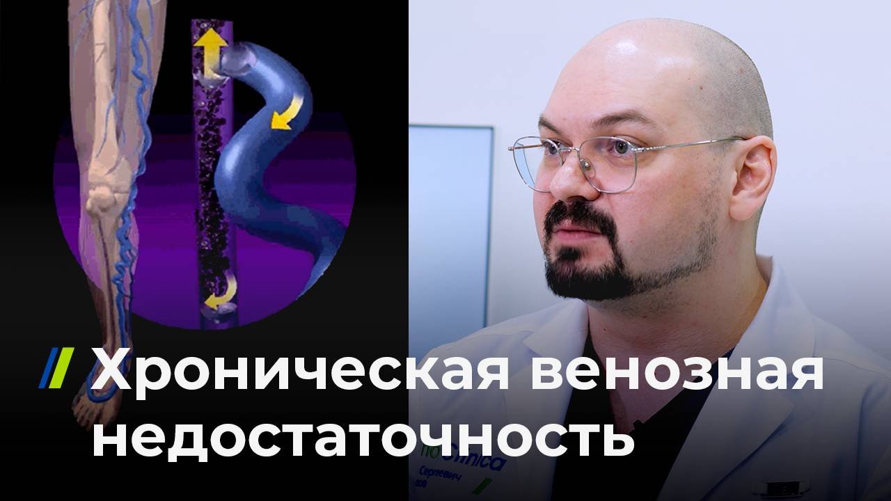 Хроническая венозная недостаточность