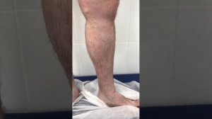 Осмотр флеболога Сардара Алиханова. Флеболог. Москва.