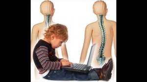 Какая осанка у вашего ребенка. Почему начинает портиться осанка у ребенка. Здоровье и осанка ребенк