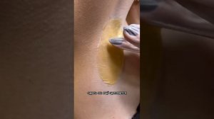 Депиляция подмышек