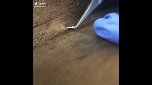 Вросший волосы/Relax Every Day ?Самое залипательное видео