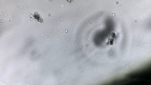 жидкость растения с микробами смотреть онлайн