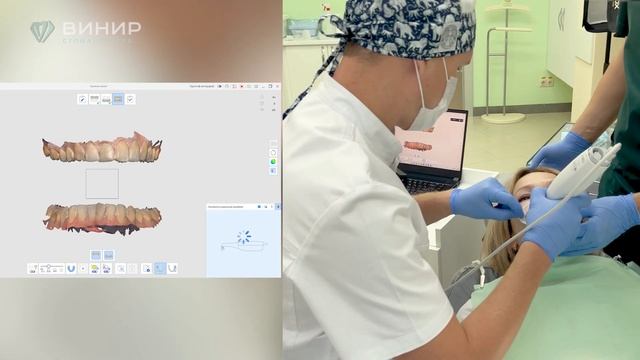 3D интраоральный сканер для полной оценки ротовой полости: Детали от Д.С. Бекшанова