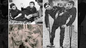 Сестры Кривошляповы: что стало с самыми известными сиамскими близнецами