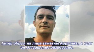 Орландо блум перестал следить за собой