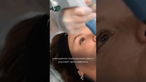 Про аппарат Exilis Ultra 360