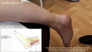 Posterior Tibial Nerve Block Блокада большеберцового нерва по Брауну Техника блокады лодыжки 