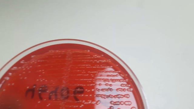 E. coli Colony Morphology смотреть онлайн