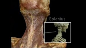 3 4 ременная мышца