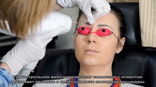 Удаление микроблейдинга бровей